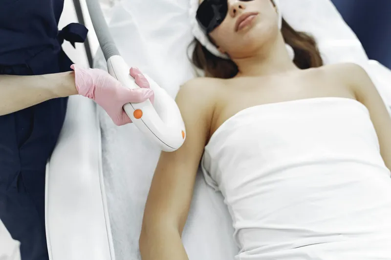 Hårborttagning med laser – så fungerar det, vad det kostar och hur länge det håller