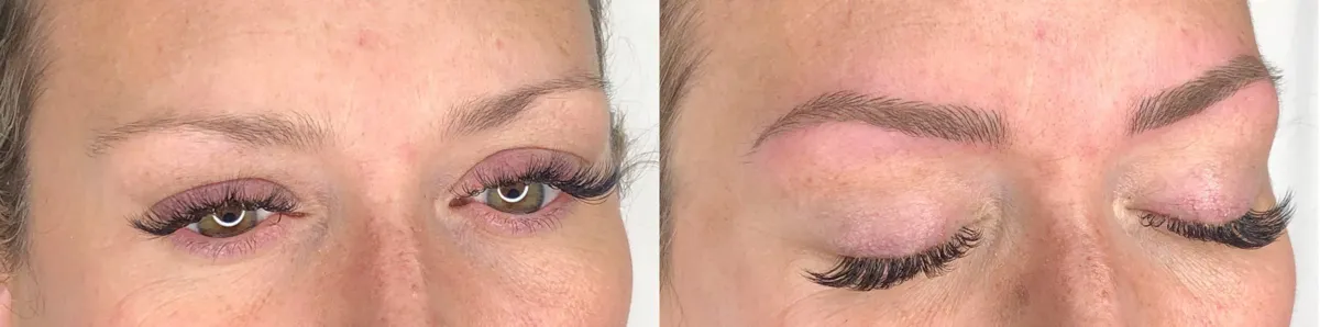 Steg för steg: så går en professionell behandling till